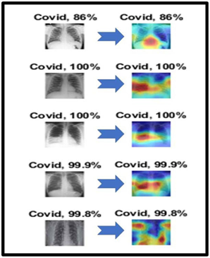 Artificial Intelligence based system for COVID-19 detection