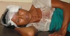 Powerful blast at Kumarikata: 5 dead, 50 injured