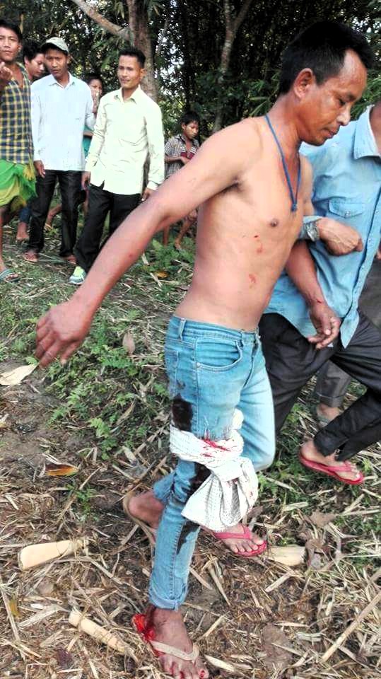 11 injured while chasing leopard