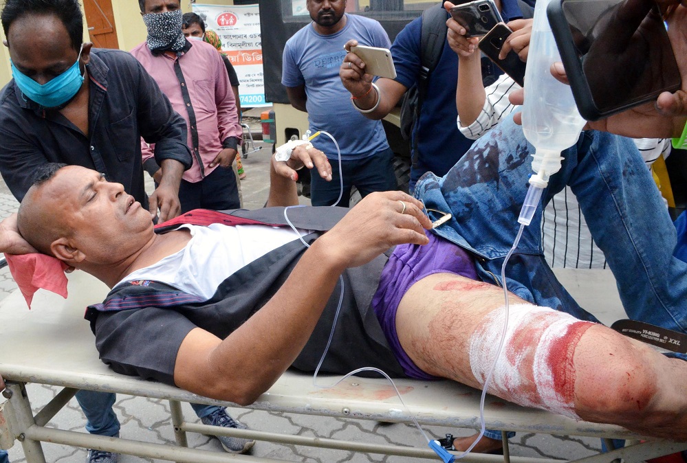 Civilian hurt in Nagaon police firing