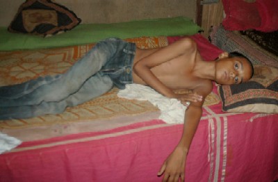 Diarrhea hits Guwahati once again