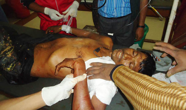 ULFA explodes grenade in Tinsukia; 10 injured