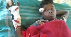 Injured child labour critical 